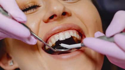 Les conseils des dentistes pour éliminer facilement le tartre des dents en un tour de main