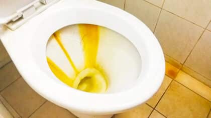 L’astuce maison la plus efficace pour éliminer la triple ligne jaune et le calcaire des toilettes