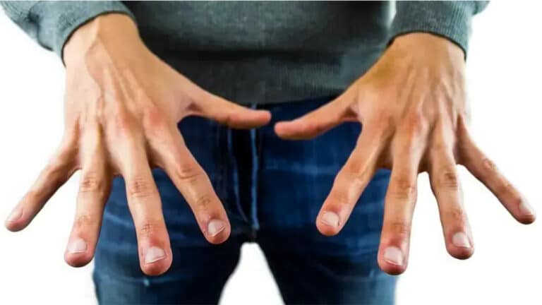 5 signes silencieux du cancer qui peuvent apparaître sur vos ongles, selon les médecins