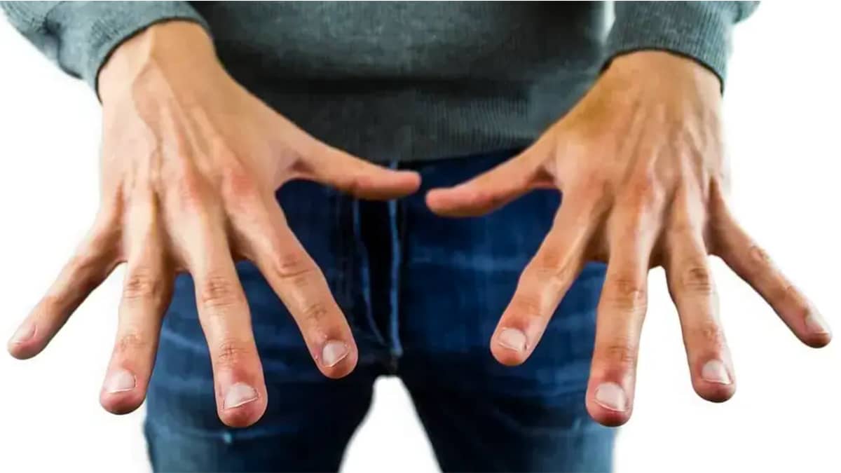 5 signes silencieux du cancer qui peuvent apparaître sur vos ongles, selon les médecins
