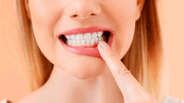 Comment éliminer le tartre de vos dents naturellement chez vous: l'astuce la plus simple et la plus efficace