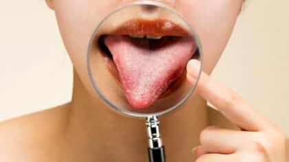 La couleur de votre langue peut révéler des problèmes de santé : voici quand vous inquiéter