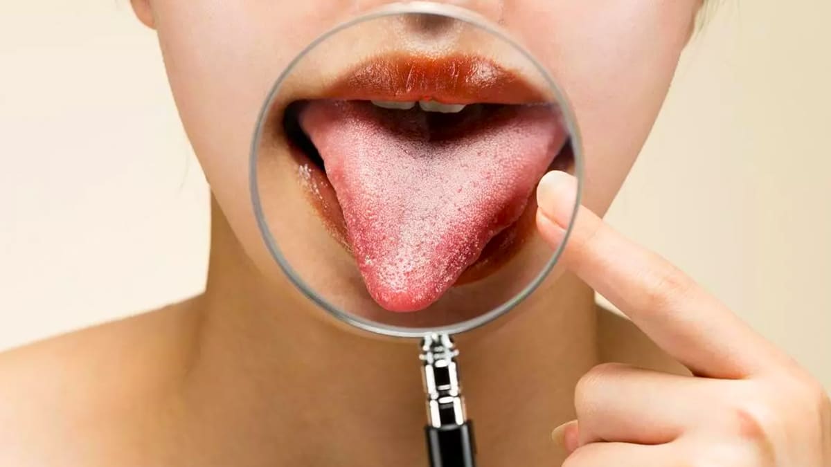 La couleur de votre langue peut révéler des problèmes de santé : voici quand vous inquiéter