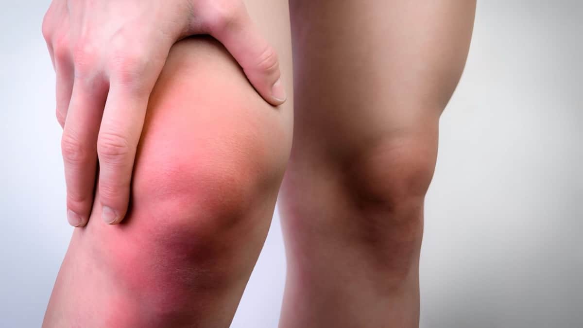 Rougeur et gonflement des jambes : quelles sont les implications ? Un médecin répond.
