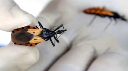 Maladie de Chagas : symptômes, origines et prévention