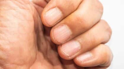  Des lignes et des sillons sur les ongles : ce qu’ils révèlent sur votre santé