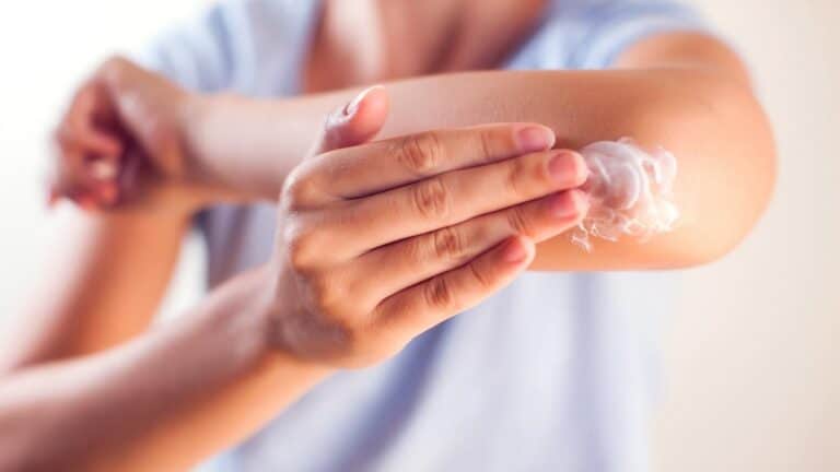 Dermatite atopique et cosmétiques : l'astuce infaillible pour éviter les allergies cutanées