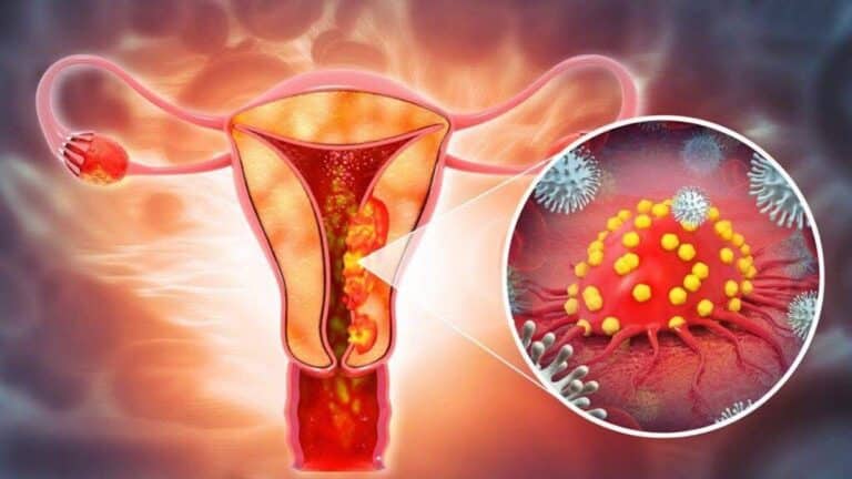 Signes indiquant que le cancer se développe dans votre corps