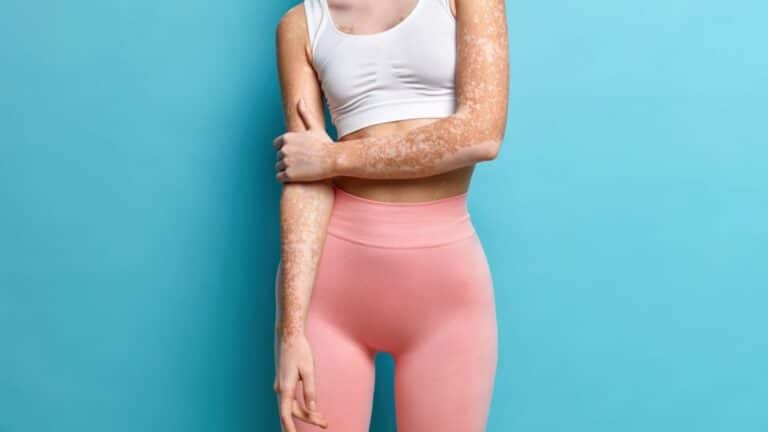 Le « Thigh Gap » ou l’espace entre les cuisses, la nouvelle tendance virale chez les femmes