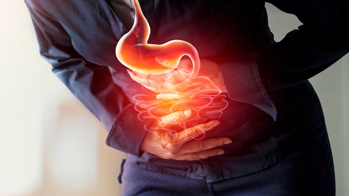 Cancer gastrique : comment reconnaître les symptômes et quels changements alimentaires les experts recommandent