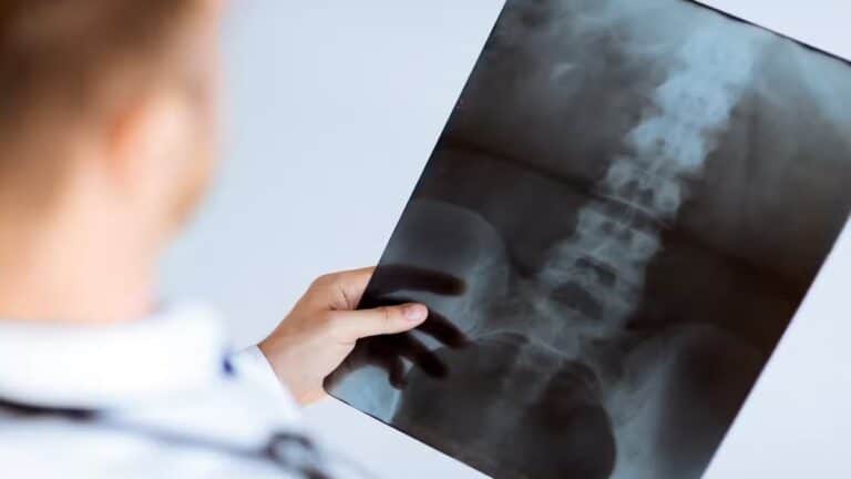 Les médecins sont choqués par ces radiographies : ce qu'ils ont découvert dans leurs articulations vous laissera sans voix