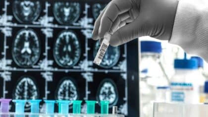 Attention : ce médicament pourrait augmenter le risque de maladie d'Alzheimer, selon une étude récente