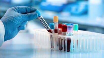 Les chercheurs identifient le groupe sanguin présentant la plus faible probabilité de cancer