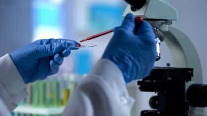 Ils ont découvert qu'un test sanguin permet de détecter 14 types de cancer. Cette méthode pourrait sauver des millions de vies !